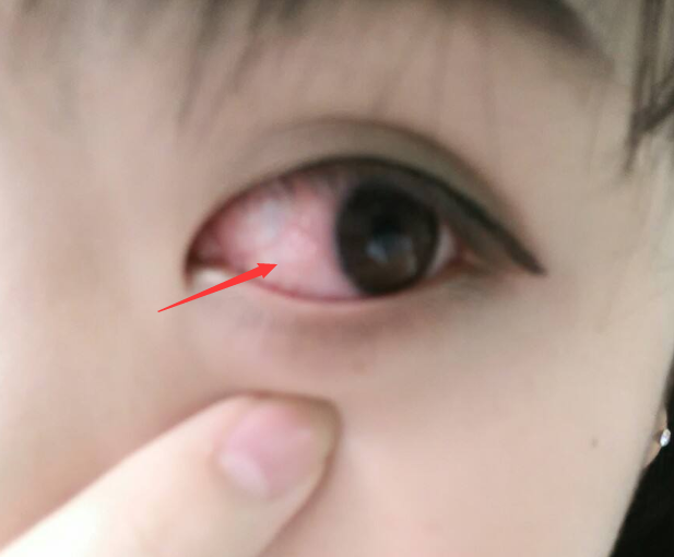 青春期最"伤"眼睛的3行为,玩手机不算啥,它才是"重中之重"