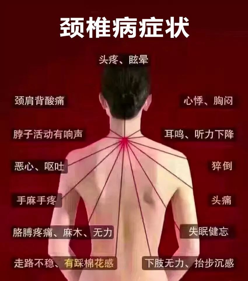 千万不要小看颈椎病,颈椎病不仅会影响形象,严重的颈椎病甚至很容易