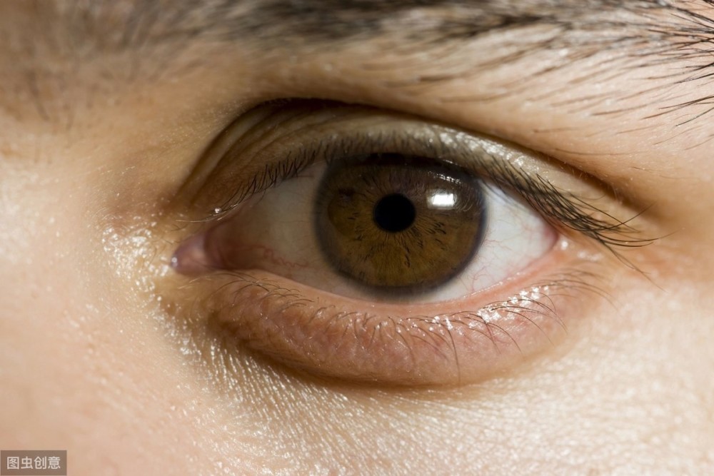 主要有眼白变黄,皮肤变黄,尿液液异常发黄这"三黄"表现,都说明病人肝