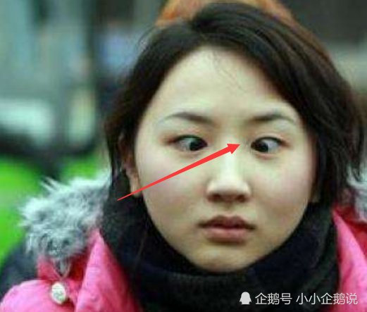 鱼泡眼