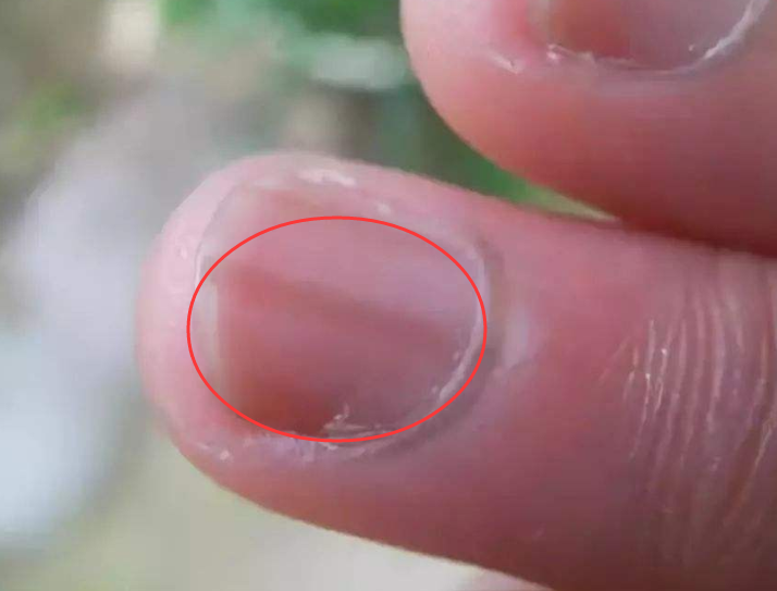最好去医院检查一下,在日常的生活中,男生可以吃一些黑豆,黑芝麻之类