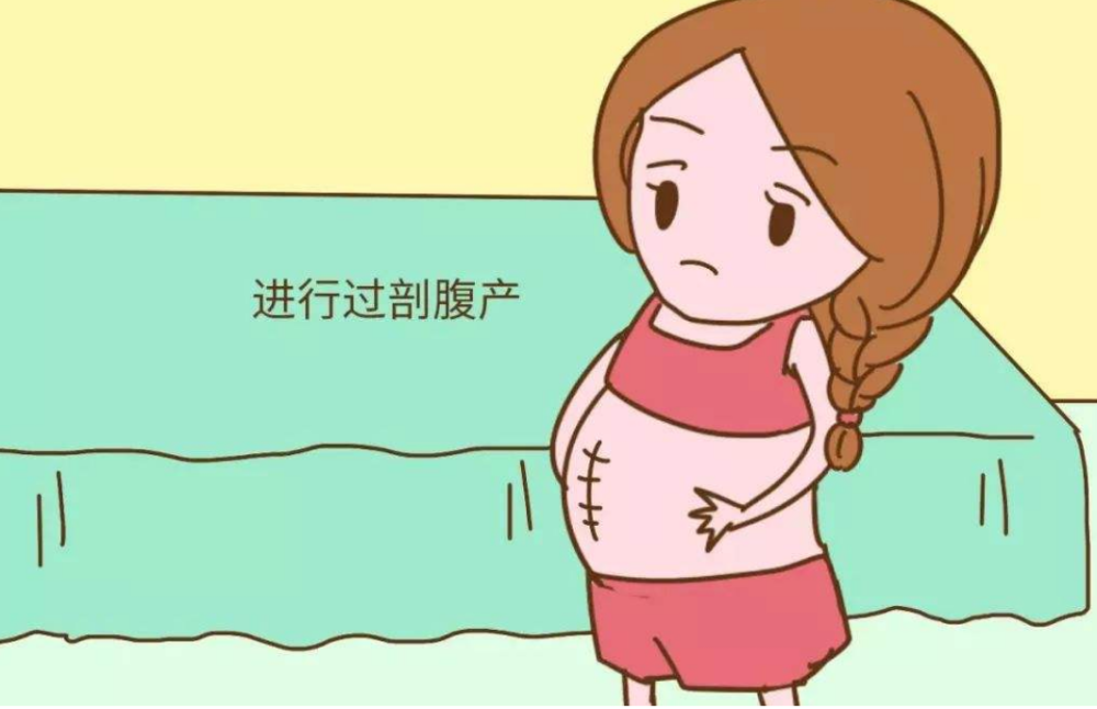 盆腔粘连