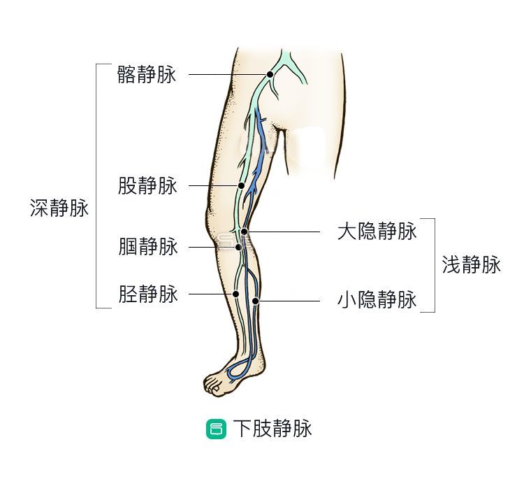 腿上"青筋"竟会导致烂腿?解密下肢静脉曲张的10个真相