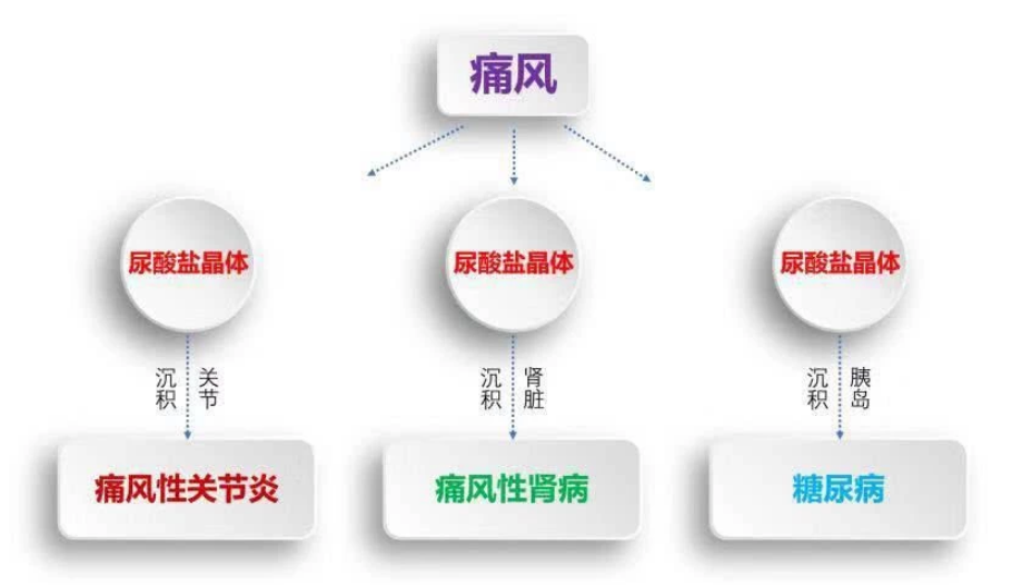 老年人痛风常发作,疼痛难忍!一招尿酸自动降低,不再发作