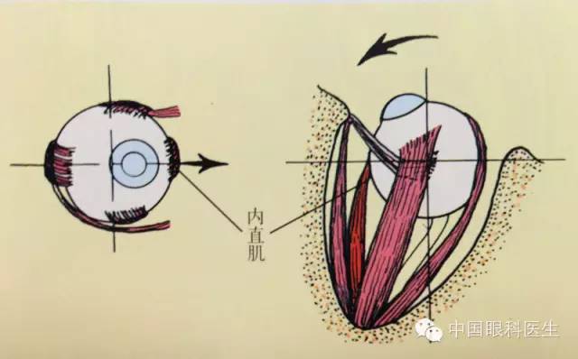 单独内直肌的作用(右眼)左正面观-右上面观-箭头方向示内直肌收缩产生
