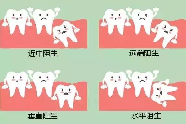 拔智齿可以瘦脸?牙科医生:不要异想天开啦