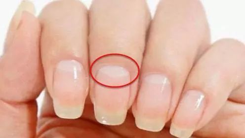 老人常说,手指甲上的月牙多少,意味着我们的身体是否健康.