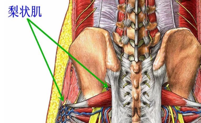 经常屁股疼腿疼,可能是梨状肌综合症,试试这3招瑜伽