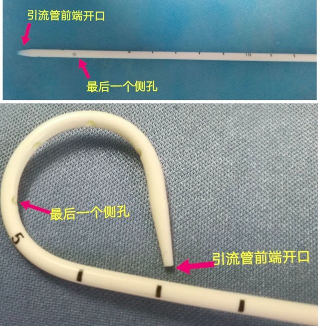 胸腔置管引流,引流管置入多深最合适?