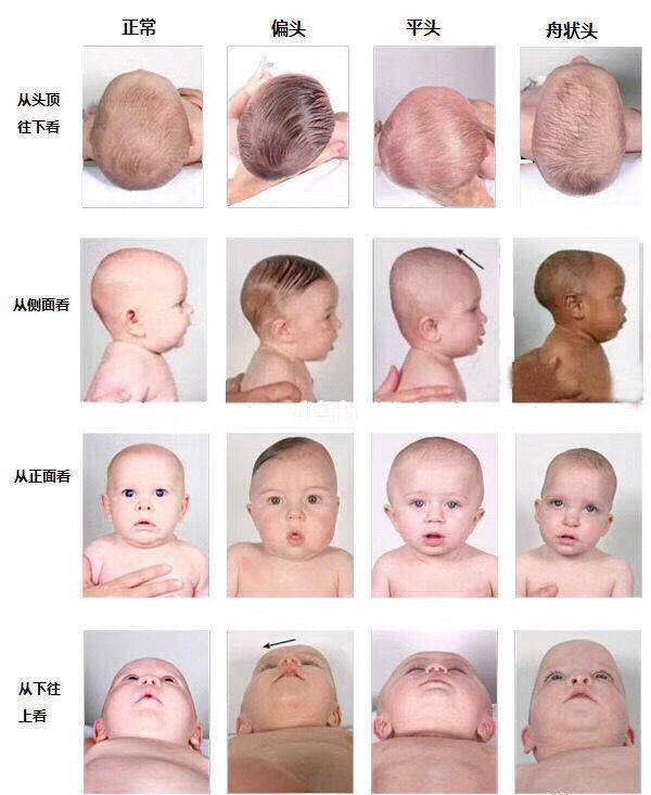 怎样帮宝宝睡出一个漂亮的"头型"?塑造完美头型,靠这