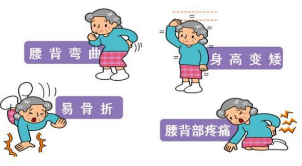 不止老人儿童需要补钙,成年人也有可能缺钙哦