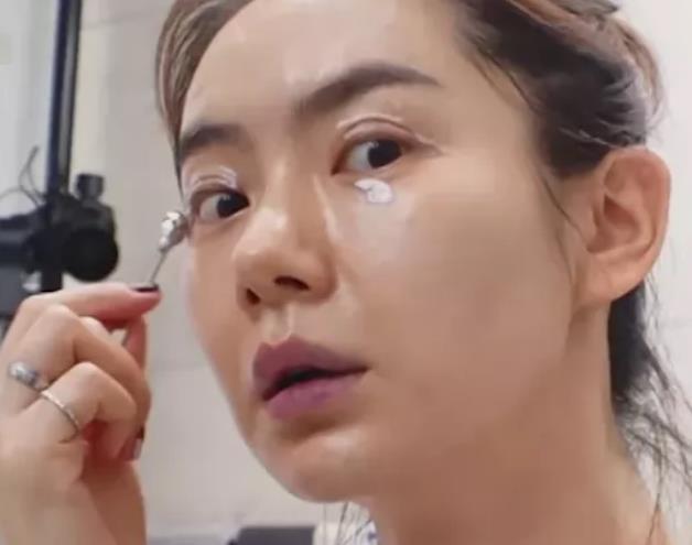戚薇分享素颜护肤过程,大方晒双眼皮疤痕,网友:够霸气!