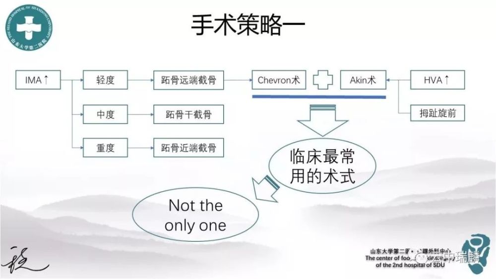 间角(ima)增大,纠正hva增大(多合并拇趾旋前)常用的术式为akin截骨术