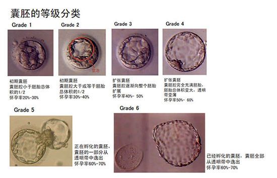 所以经过囊胚培养考验的胚胎 更具有发育潜能,着床率更高