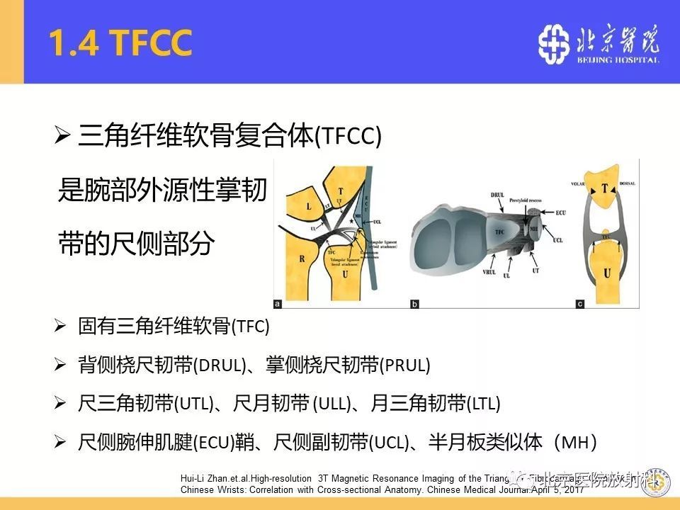 一文掌握三角纤维软骨复合体tfcc损伤