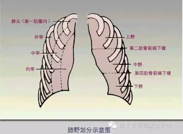 这6大胸片读片技巧,影像医生必须烂熟于心