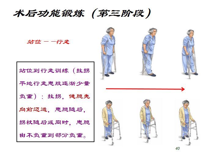 骨折术后的康复功能锻炼(含上肢,下肢)