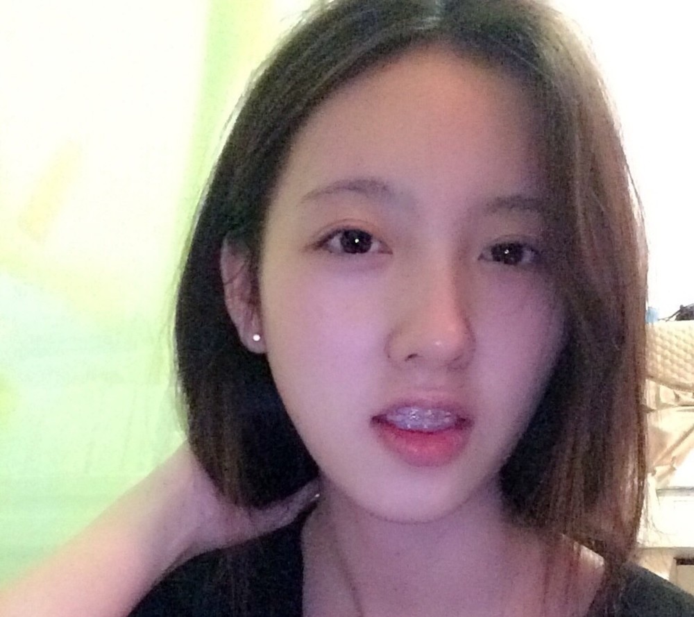 戴着牙套的女孩,张嘴拍照也好看