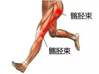 如髂胫束损伤时其疼痛主要在臀部,但可沿大腿外侧影响至小腿外侧,且