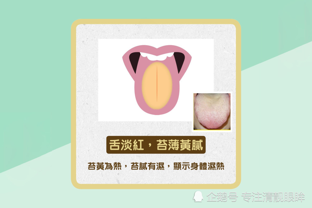 体内有病舌先知,舌头若出现这些异常,是身体向你发出健康警示
