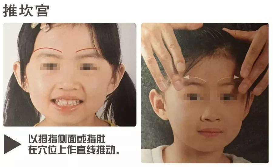 小儿推拿治疗腺样体肥大要趁早