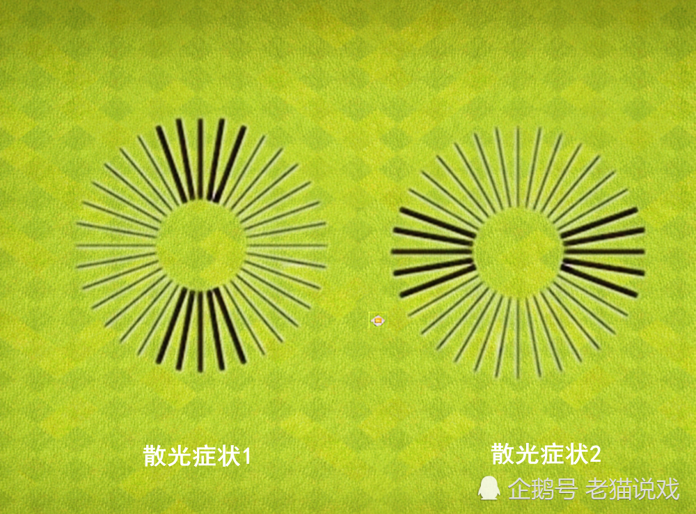 若被检的眼睛看到散光图中,某一条线粗且线黑,或者格外清晰的时候