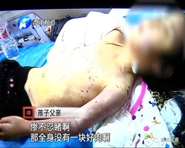 4岁女孩因和奶奶太亲近 竟被亲生妈妈虐待致死