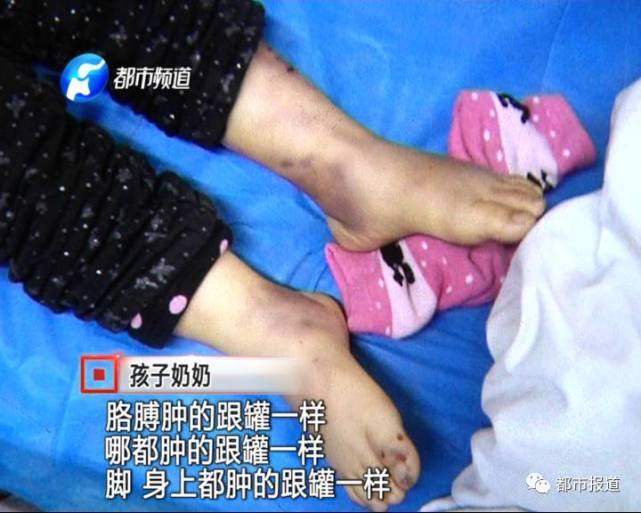 4岁女孩因和奶奶太亲近 竟被亲生妈妈虐待致死