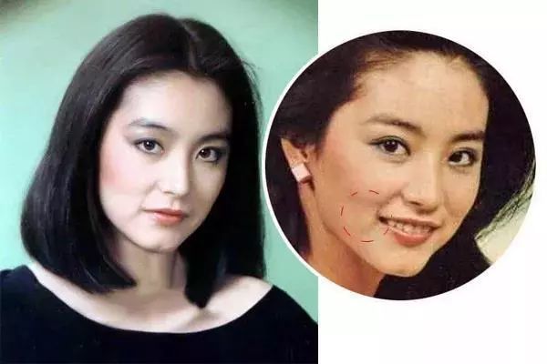 松鼠肌怎么改善面部按摩必不可少