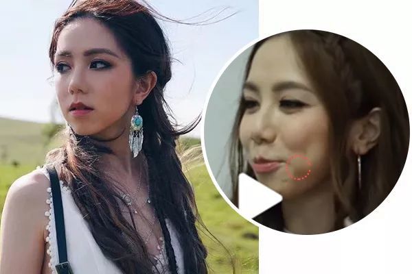 "松鼠肌"怎么改善?面部按摩必不可少