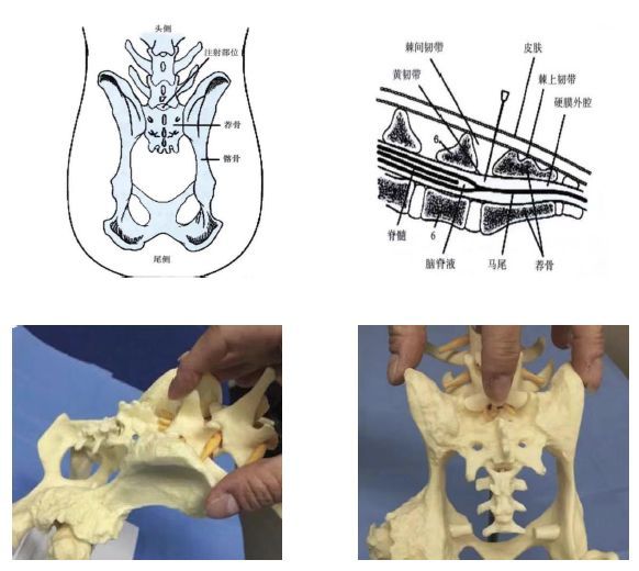 操作:动物俯卧,后肢俯卧向前拉,触诊左右背侧髂骨脊柱,l7棘突和骶正中