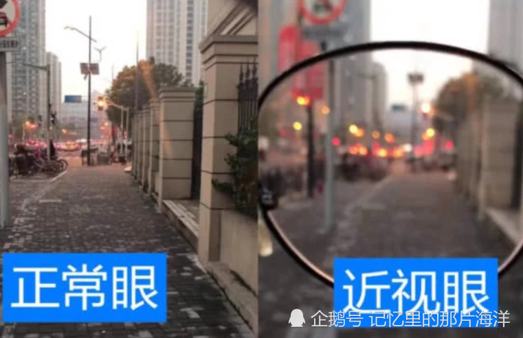 同样是眼睛,正常眼vs近视眼,网友:这就是我不打招呼的