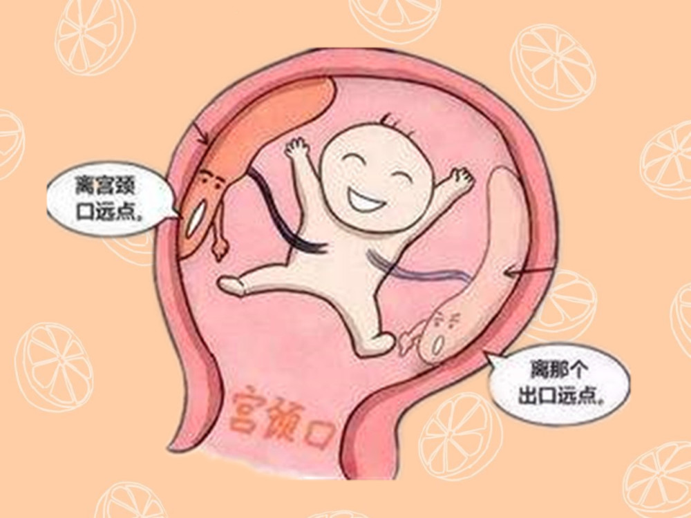 孕期出现胎盘前置,和这些因素脱不了干系,希望你能