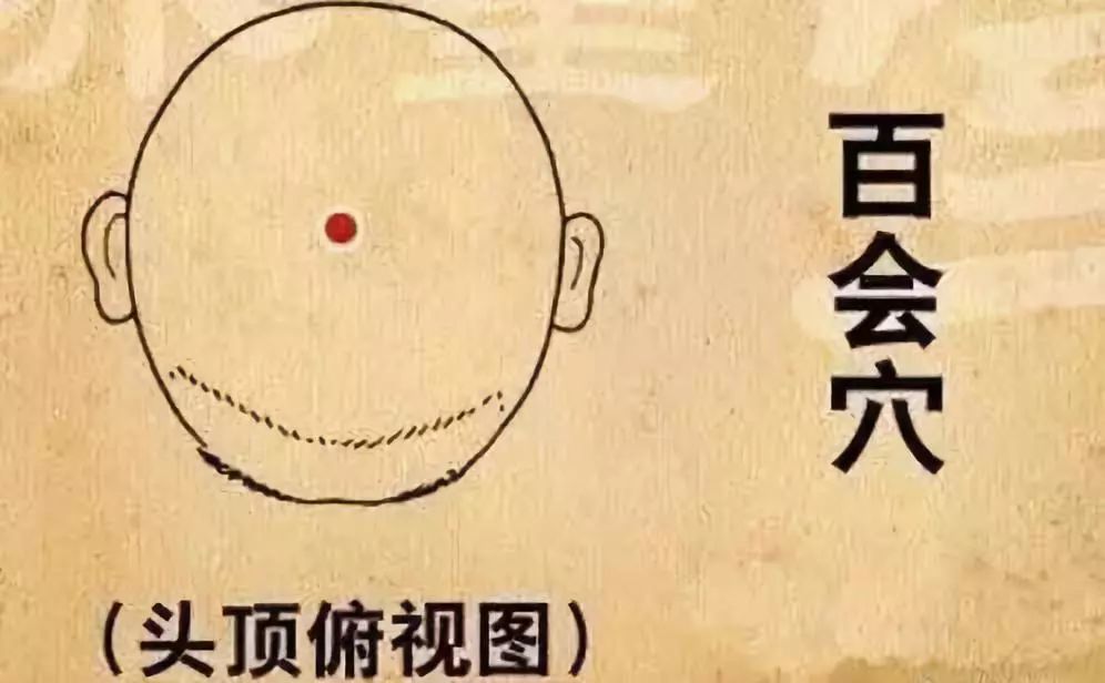 運動后頭痛
