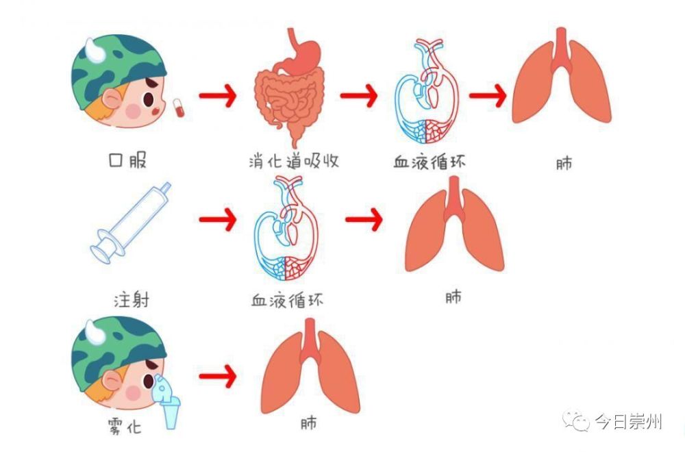 雾化吸入的适应症