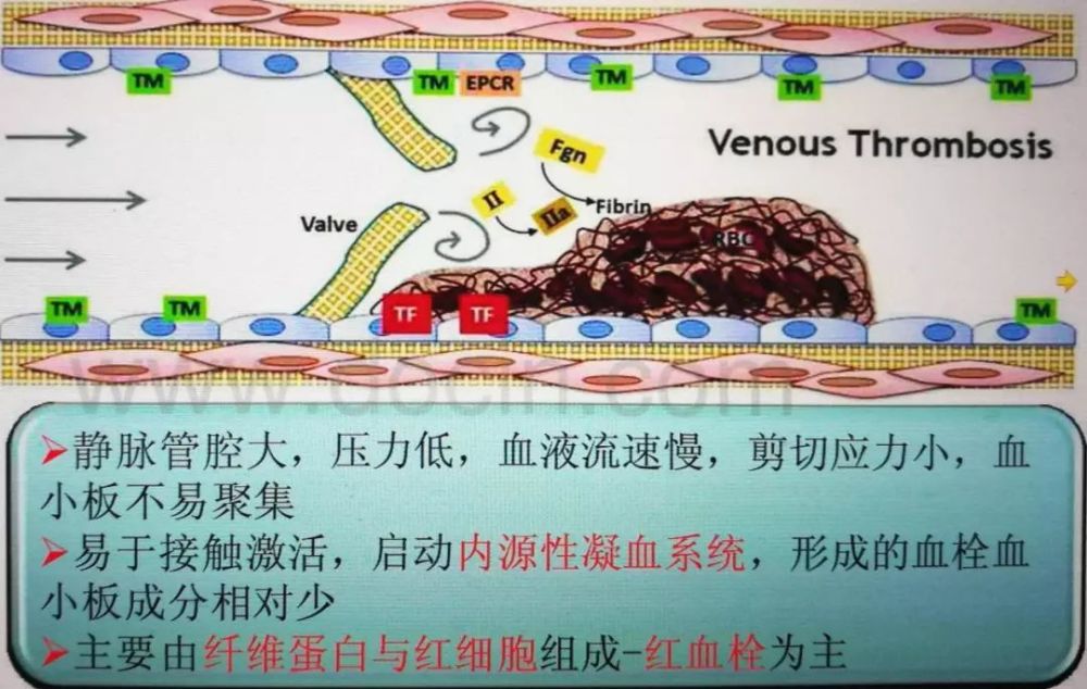 马壮教授面对vte魏尔啸三角溶栓手术介入均非基本治疗唯有抗凝才能稳