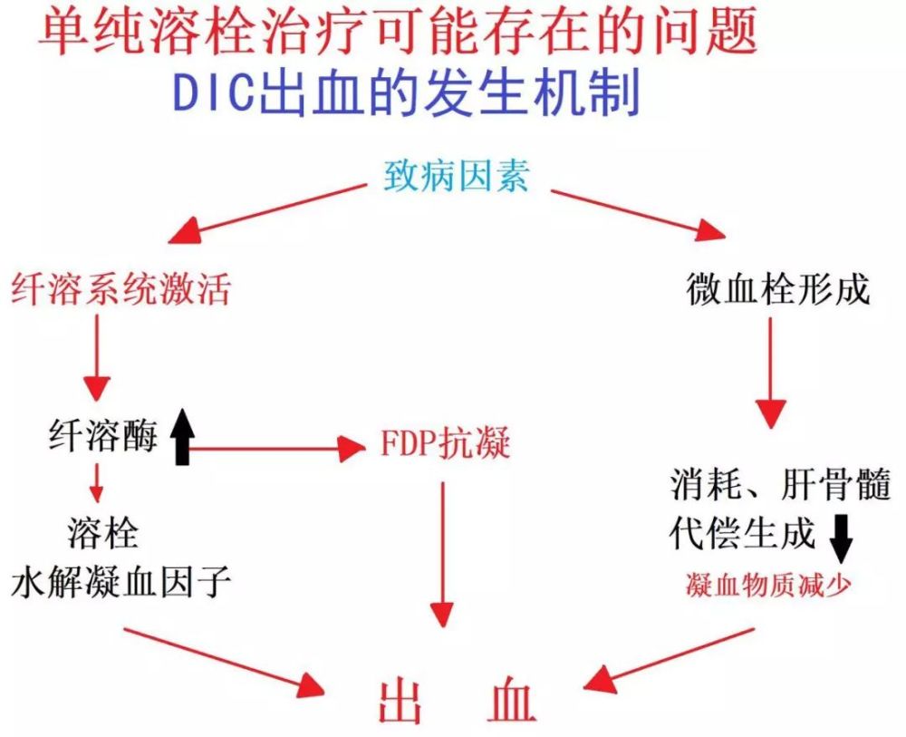 马壮教授面对vte魏尔啸三角溶栓手术介入均非基本治疗唯有抗凝才能稳