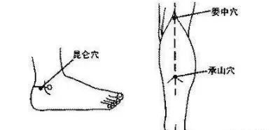 07膀 胱 经八髎穴,委中穴,承山穴,昆仑穴八髎穴瘀堵,主要有2种情况