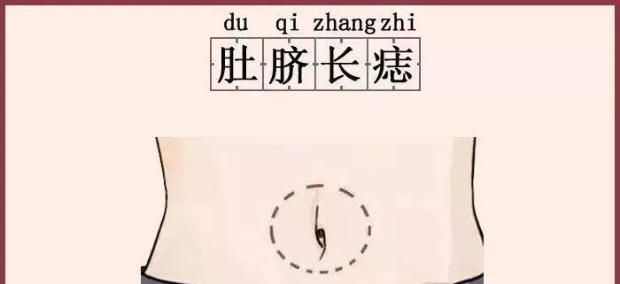 这4颗痣别点掉一个颗比一颗值钱