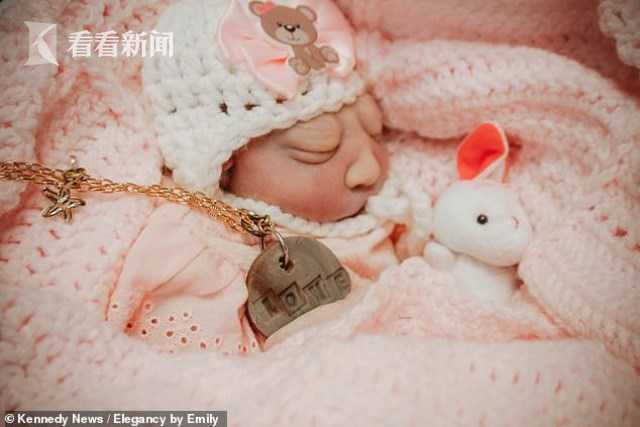 母亲执意产下无脑畸形婴儿 为啥不听劝