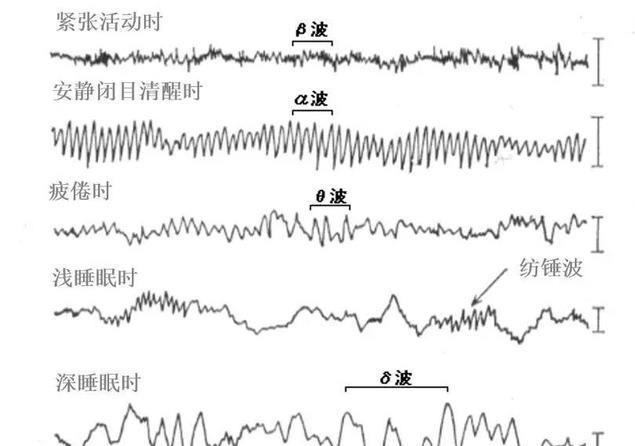 昏睡简谱_美女昏睡(3)