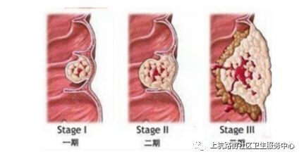 1, 腹部包块.