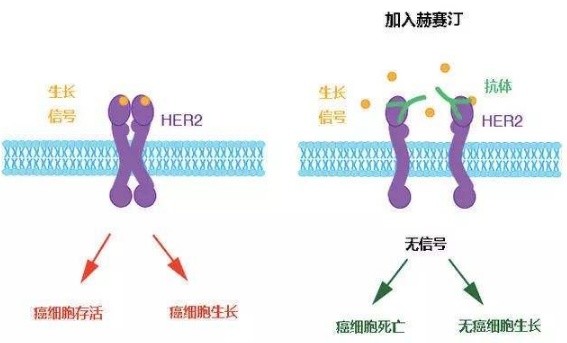 名医专访 泰州人民医院易彤波:her2阳性乳腺癌靶向治疗