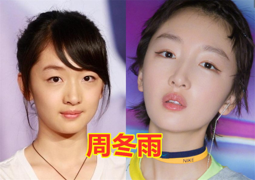 明星"割双眼皮前vs后",许凯变化认不出,戚薇美出新