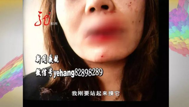 姑娘喂大型狗吃葡萄,狗扑上来一口咬住她嘴巴…鲜血