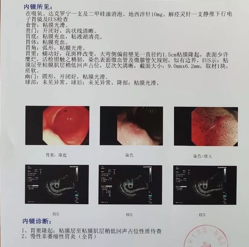 2. 因为心脏内有6个支架,能否承受该手术,风险大吗?