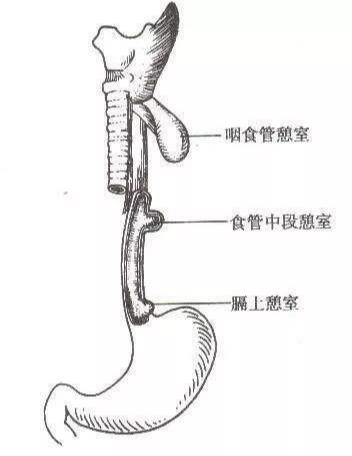 猫咪食管里长出小口袋,铲屎官们别忽视,这是食管憩室的症状