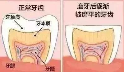 夜里磨牙怎么治疗（夜里睡觉磨牙怎么治疗）