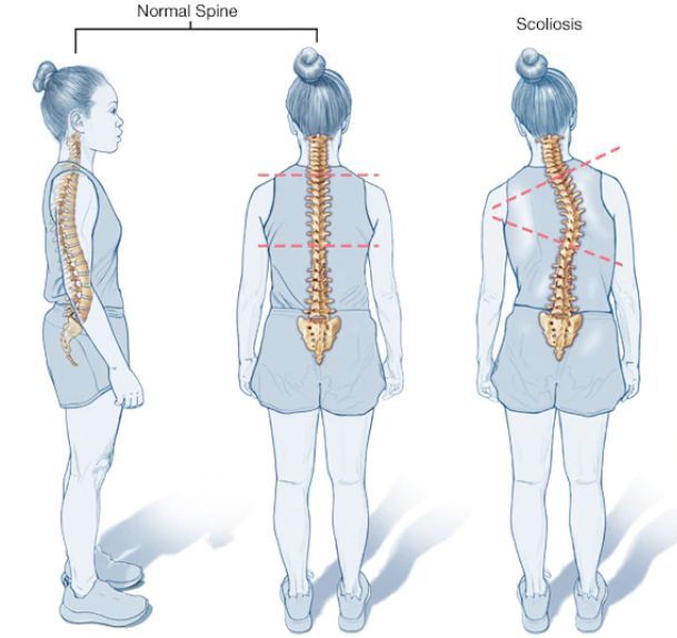 将脊柱按照不同部位从上到下分为: 颈椎,胸椎,腰椎和骶椎四部分.