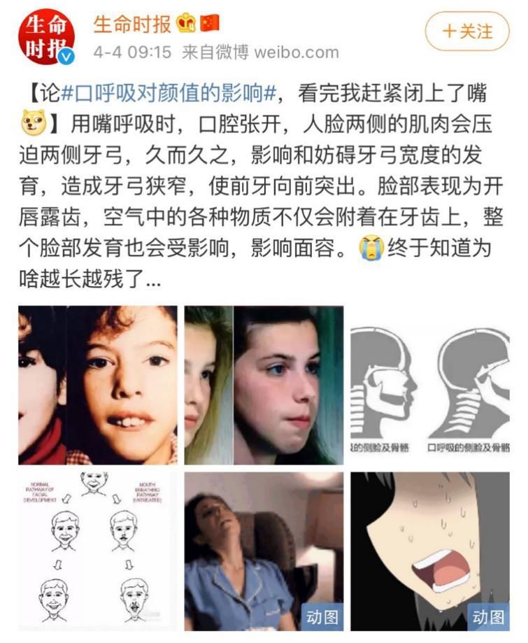 育儿家丨"张口呼吸"不仅直接影响宝宝的颜值,更会导致